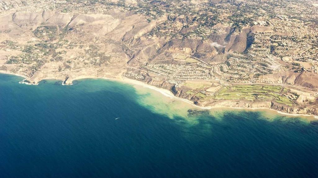 탈모약 보험 적용 시 가격 비교 TOP 5 (2026년 최신 정보)